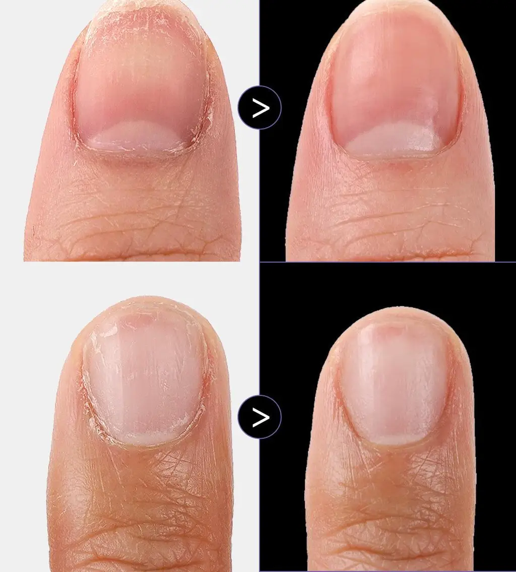 [대용량] 위드샨 네일&큐티클 오일펜 올케어 세트 (4ml x 4ea) 상세페이지 3